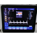 Sistema de ultra-som doppler portátil e fabricante de doppler colorido 4D